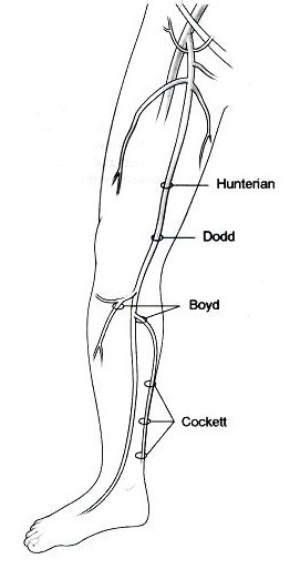 varicoza la adult